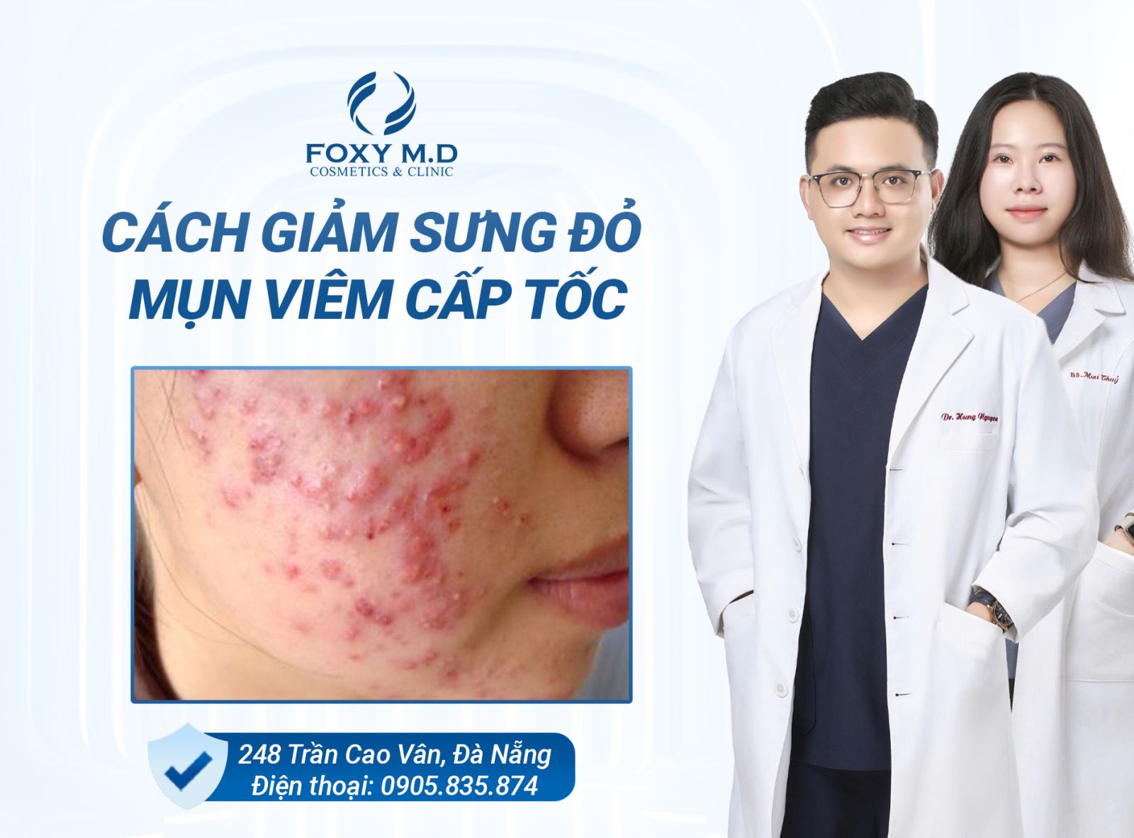 🌿 CÁCH GIẢM SƯNG ĐỎ MỤN VIÊM CẤP TỐC
